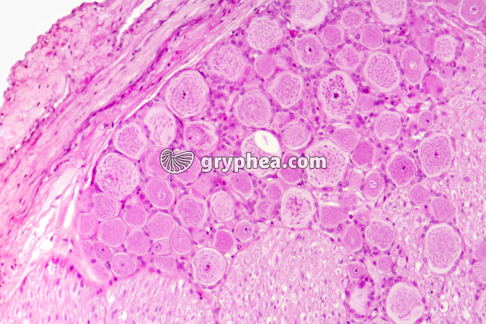 Ganglion rachidien x50 - gryphea.com